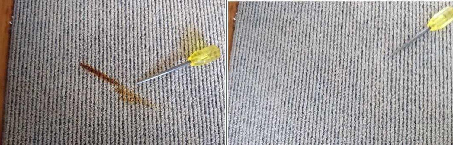 Burn repair 3: before and after